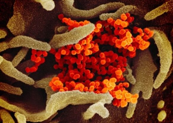 A close up of the virus that causes COVID-19.