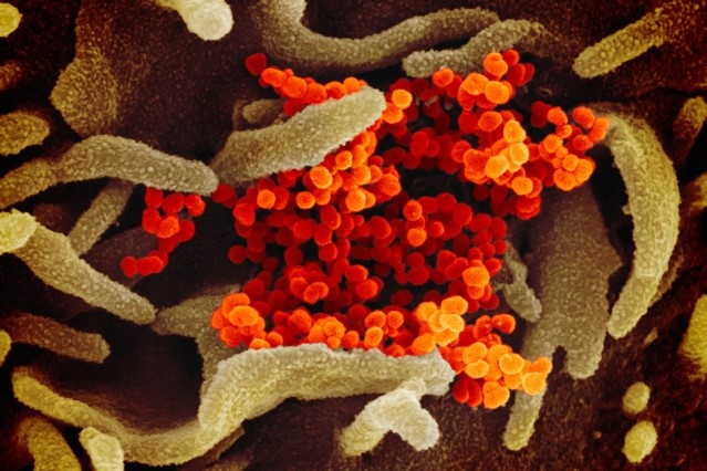 A close up of the virus that causes COVID-19.